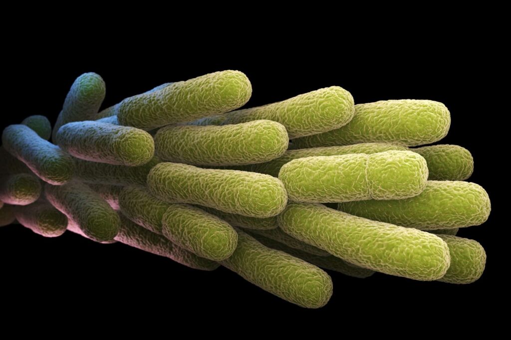 Cos'è la legionella